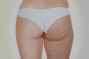 Modul 2 - Specifični pokreti MLD