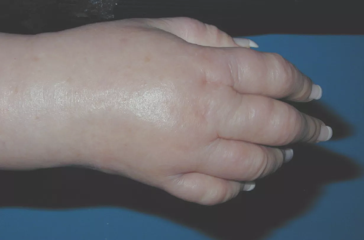 Modul 2 - Terapijske primjene